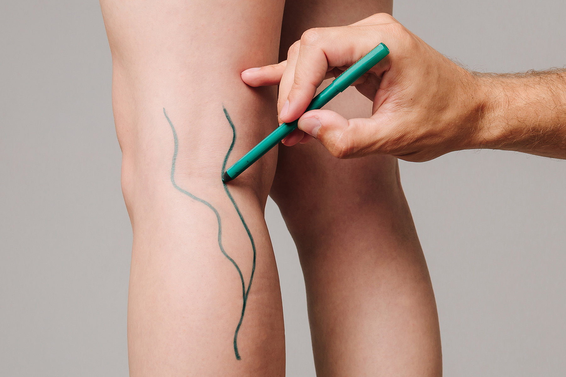 Explore the intricate leg vein circulatory system, its function, and how to maintain healthy veins. Learn about vein types, blood flow, and prevention tips.