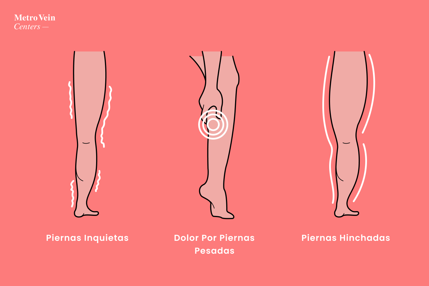 Heel España - Uno de los motivos principales del síndrome de las piernas  cansadas es la insuficiencia venosa, que provoca que las venas de las  piernas presenten cierta dificultad a la hora